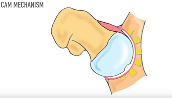 a diagram of a knee with a small patch in the middle of it.