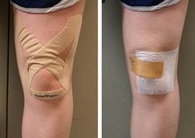 a pair of legs with bandages on them.