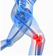 Understanding Patellofemoral Pain Syndrome: What You Need to Know | RecoverRx