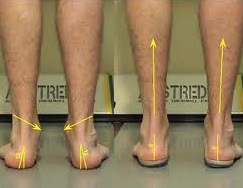 a picture of a person's legs and ankles.